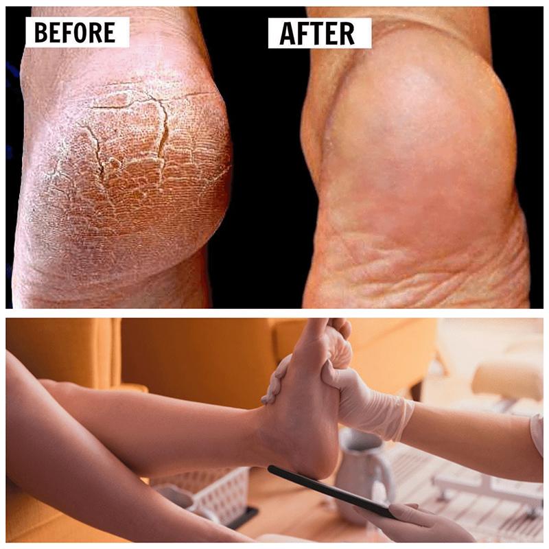 2022 New Pedicure Foot File