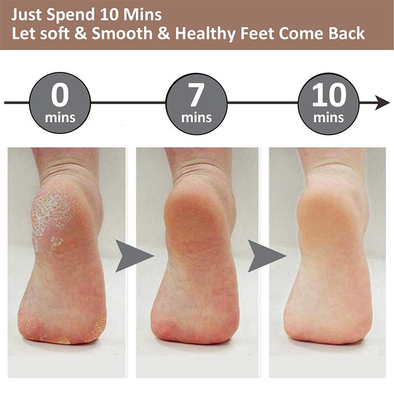 2022 New Pedicure Foot File